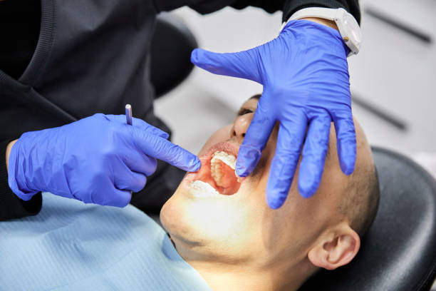 Best Teeth Whitening  in Dewitt, MI